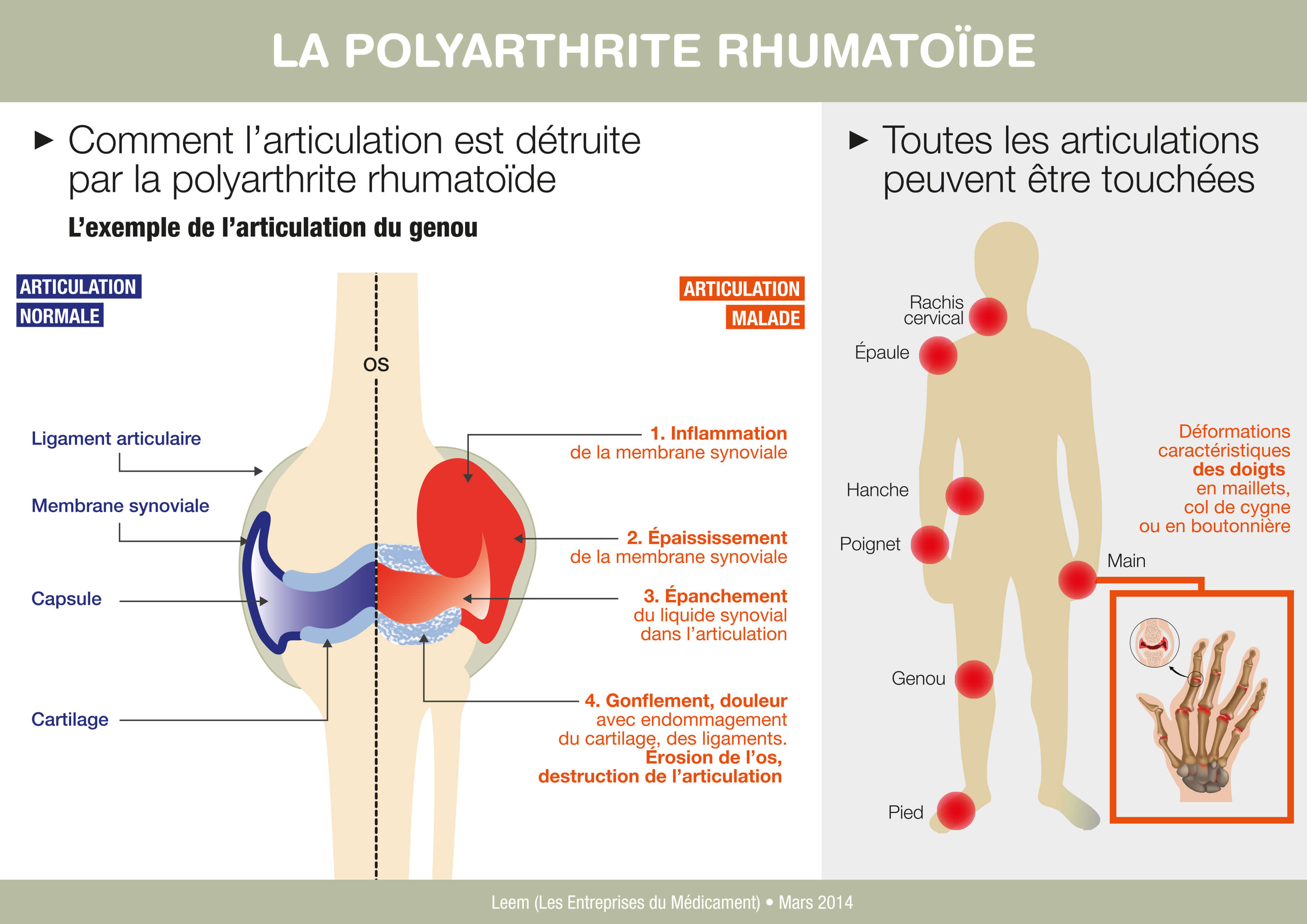 Bilan du progrès thérapeutique 2013