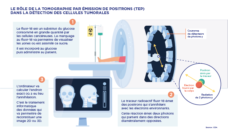 Comment l’imagerie accélère-t-elle l’innovation thérapeutique ? 