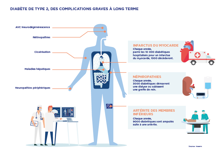 Diabète de type II : des complications redoutables - AlloDocteurs