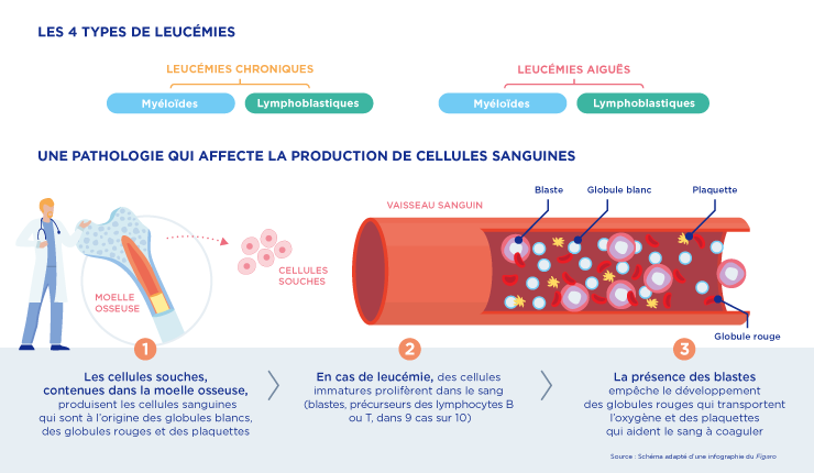 Leucémies