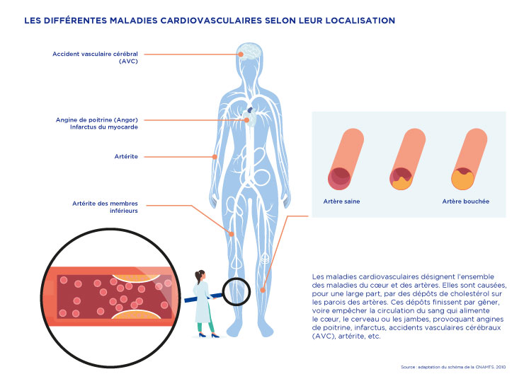 Cardiovasculaire