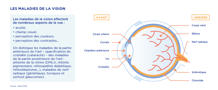 maladies de la vision