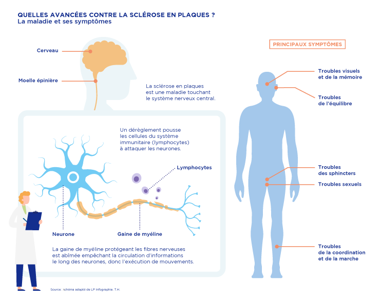 Quelles avancées contre la sclérose en plaques ? | Leem