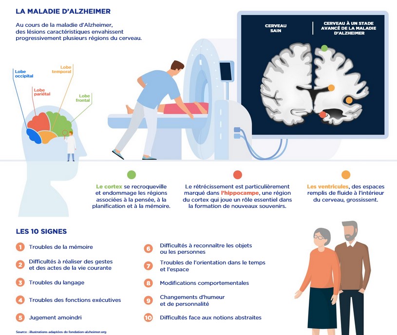 Journée mondiale de la maladie d'Alzheimer