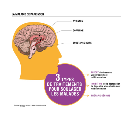 Parkinson
