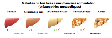 Maladies du foie