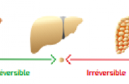 maladies du foie