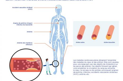 maladies cardiovasculaires