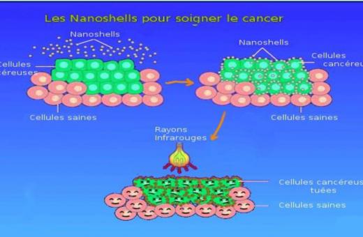 nanomédecine