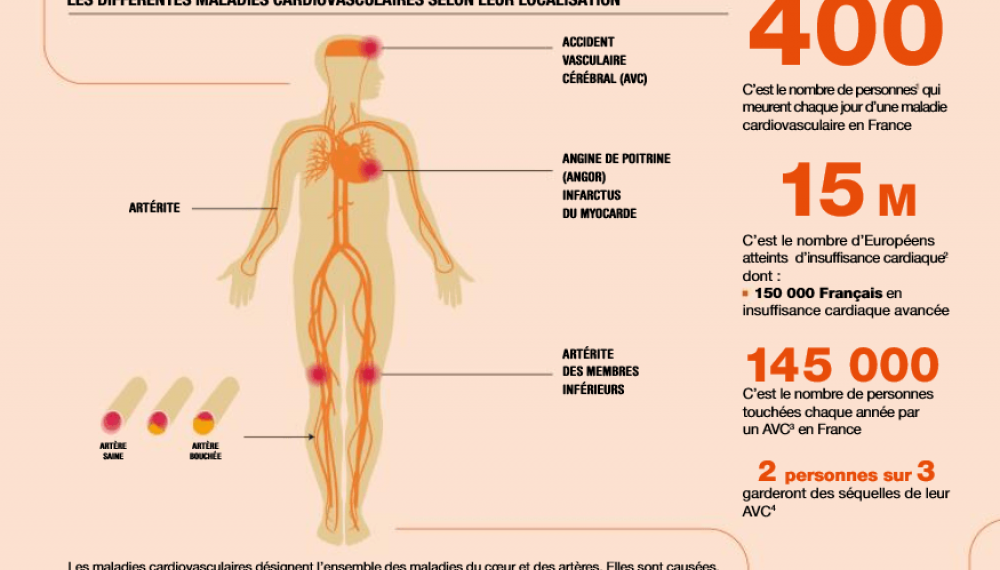 Comment enrayer le fléau des maladies cardiovasculaires ? 