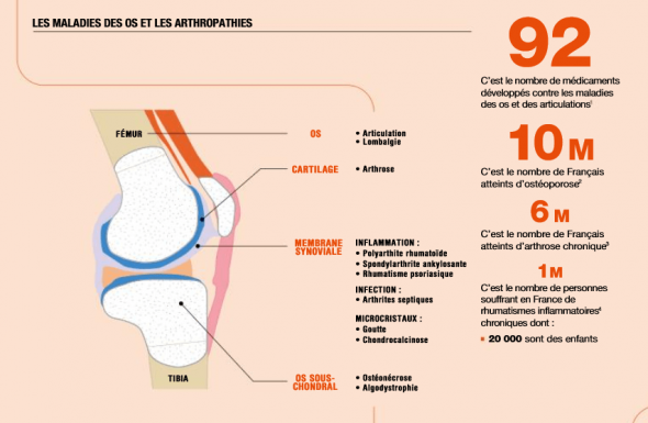 Les maladies des os et des articulations sont-elles bien prises en charge ? 