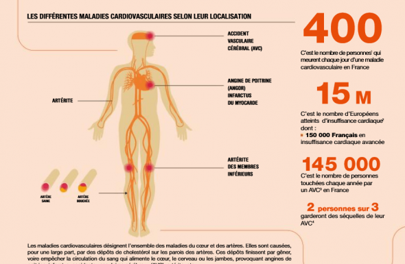 Comment enrayer le fléau des maladies cardiovasculaires ? 